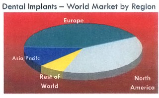 dental implant market by region