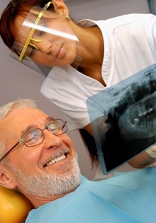 dental implants x ray