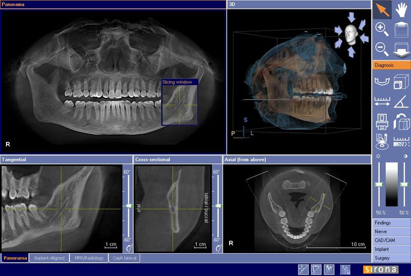 3D-Cone-Beam-Technology-naturaldentistry.us